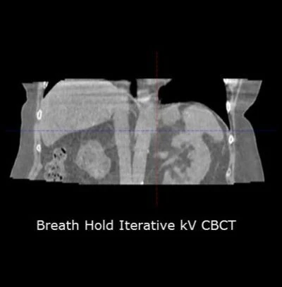 New Imaging Technologies Expand Capabilities of Varian’s Halcyon Treatment System 