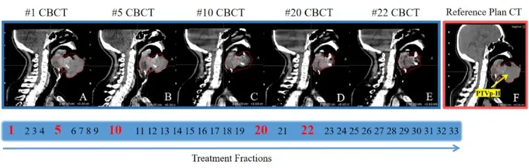 Sagittal views of CBCTs