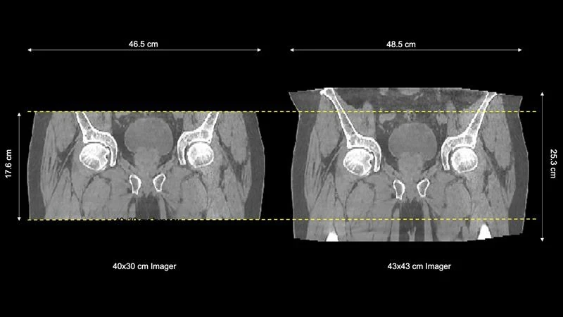 HyperSight Spotlight: Larger Field of View