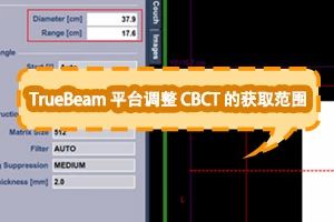 TrueBeam 平台调整 CBCT 的获取范围