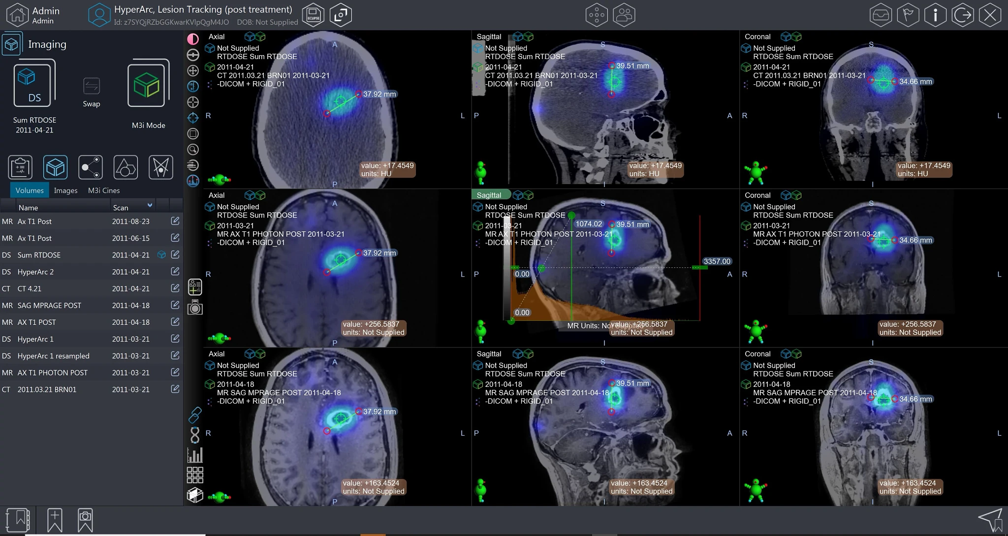 Hypofractionated Radiotherapy in the Asia-Pacific Region