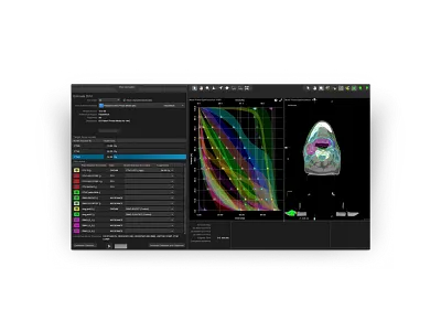 RapidPlan による治療計画作成
