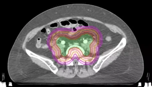 8分钟完成自动计划设计的秘诀-Eclipse API功能