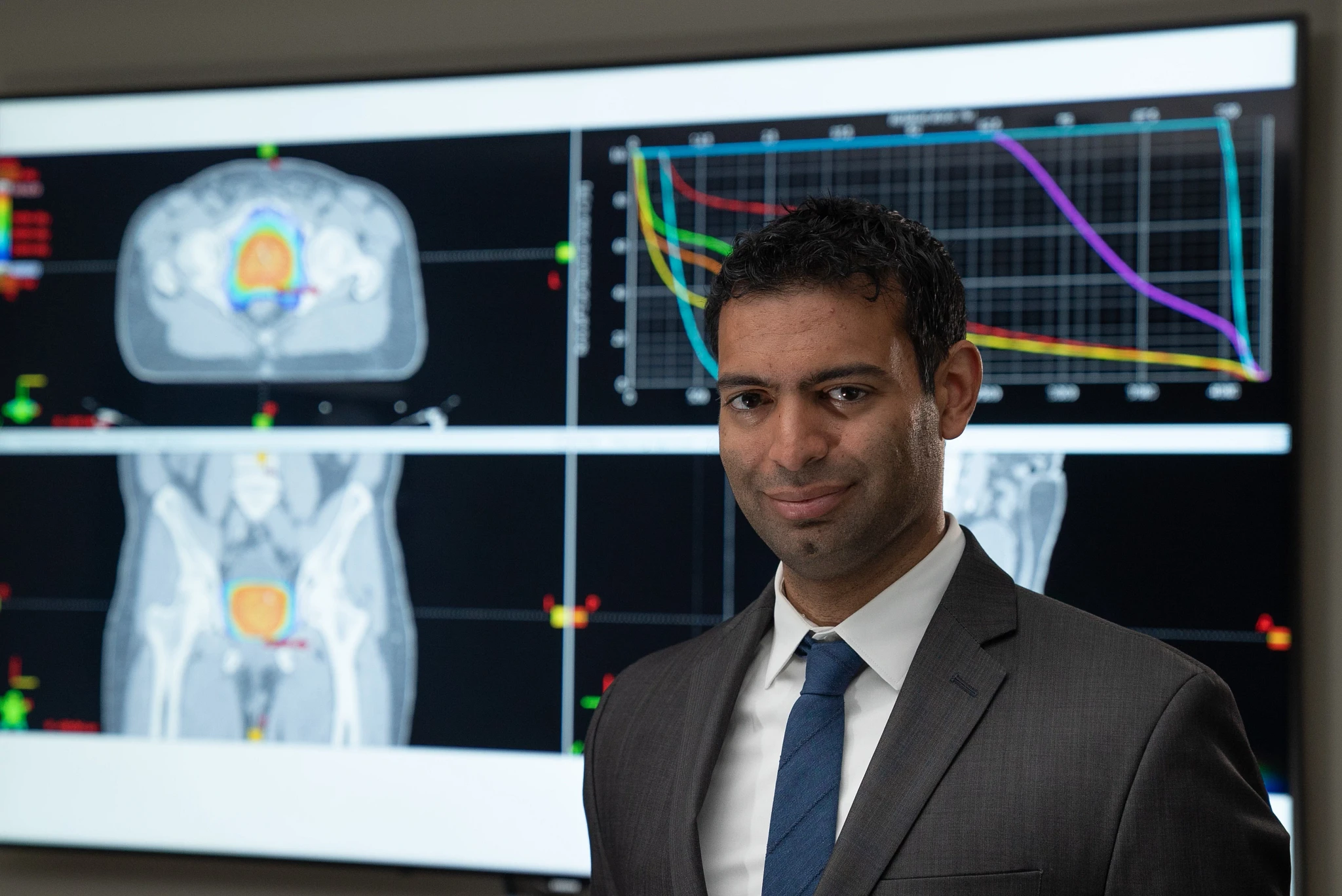 Linac-based SBRT for Prostate: Becoming a Standard Option at UCLA