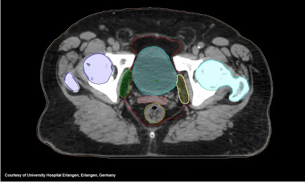 AI-Rad Companion Organs RT*