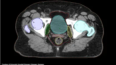 AI-RAD Companion webinar