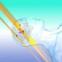 Early Adopters Find HyperArc Simplifies Delivery of Complex Radiosurgery Treatments for Brain Metastases