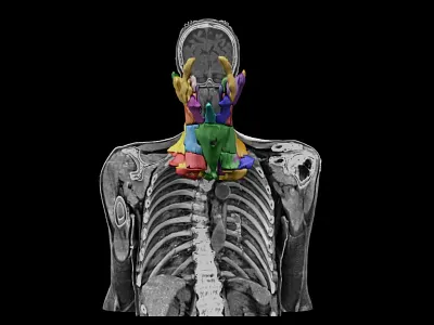 Imaging for Radiation therapy