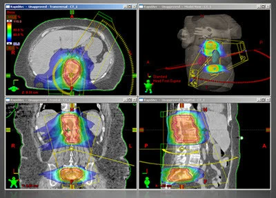 Eclipse Customers Achieve Top Scores in Treatment Plan Studies