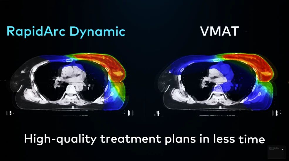 RapidArc Dynamic: High-quality treat plans in less time