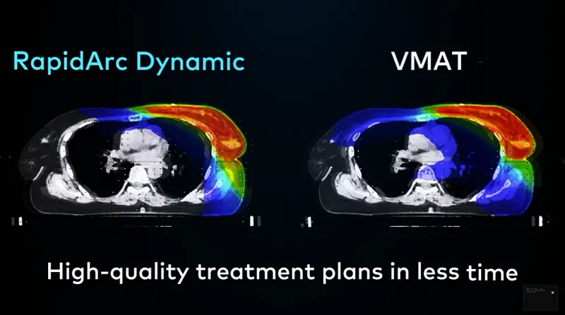 RapidArc Dynamic: High-quality treat plans in less time
