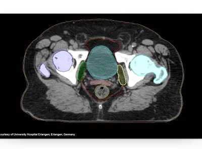 AI-Rad Companion Organs RT