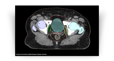 AI-Rad Companion Organs RT