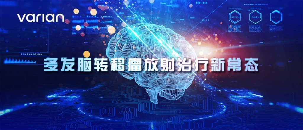 基于直线加速器的SRS成为多发脑转移瘤放疗的中坚力量  — 多发脑转移瘤治疗新常态